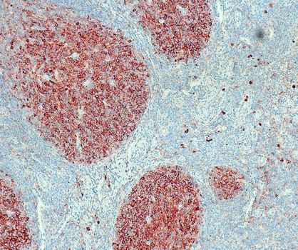 CD10 (QR021) Rb 0,5 ml konsentraatti