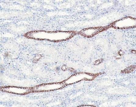 CD171 / L1CAM (QR039) Rb 0,5 ml konsentraatti