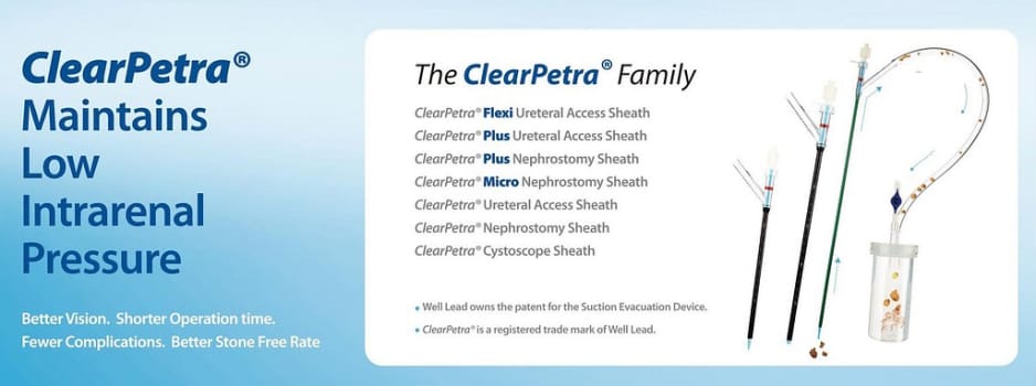 Ureteral Access Sheath, 10-12 Fr x 36cm