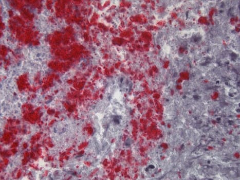 Mycob. tuberculosis polycl. Rb 0,1 ml konsentraatti