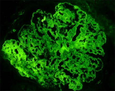IgAGM FITC Rb (Polycl) 2ml kons.
