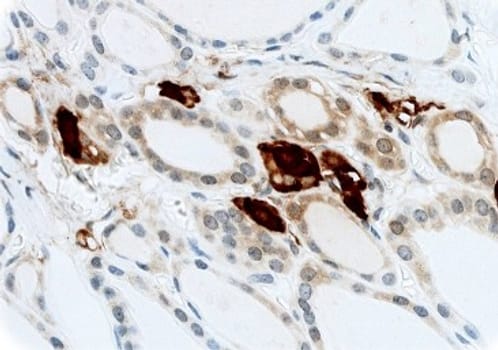 Calcitonin polycl. Rb 0,1 ml konsentraatti