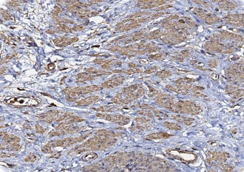 Actin, smooth muscle (1A4) Ms 0,5 ml konsentraatti
