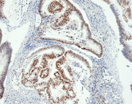 MSH6 (QR011) Rb 0,5 ml konsentraatti