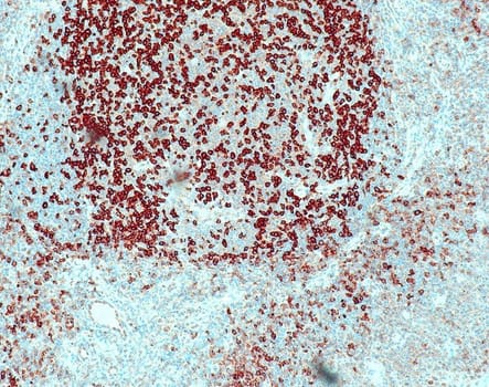 PD-1 (QR002) Rb 0,5 ml konsentraatti