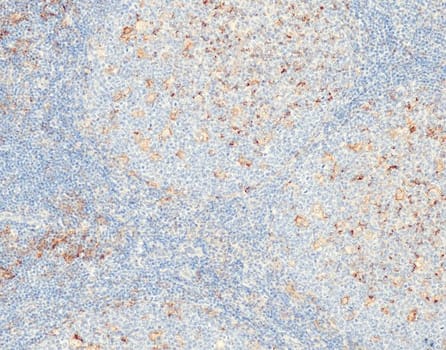 PD-L1 (QR001) Rb 0,5 ml konsentraatti