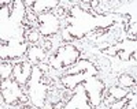 Quartett - Androgen receptor - QR135 - Kanin - 0.5ml - Konc.