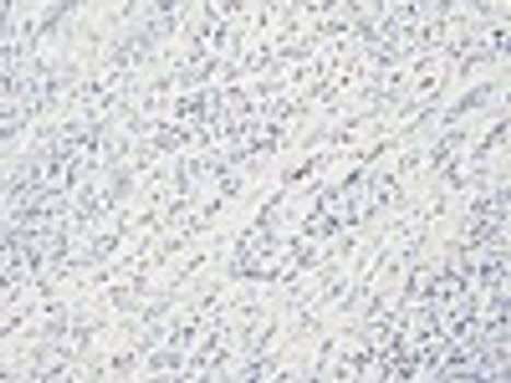 Quartett - Myogenin - QR089 - Kanin - 1ml - Konc.