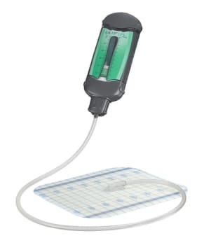 PUMPE SNAP NPWT 125MMHG KAPASITET 60ML