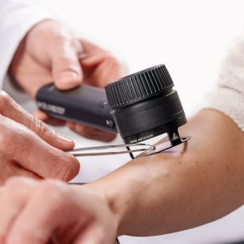 HEINE DELTA 30, distancering til Delta 30/30 Pro