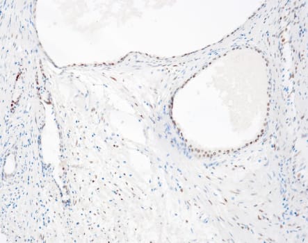 Quartett - Androgen receptor - QR135 - Kanin - 0.5ml - Konc.