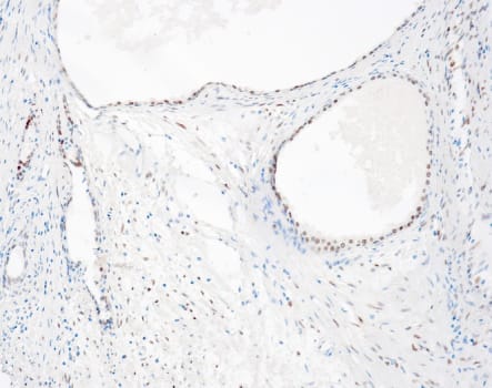Quartett - Androgen receptor - QR135 - Kanin - 1ml - Konc.