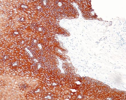 Quartett - Cytokeratin HMW - 34betaE12 - Kanin - 0.5ml - Konc.