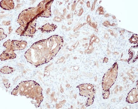 Quartett - PIN-Cocktail (AMACR/p63) - Rb./Ms. - 1ml - Konc.