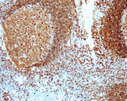 Quartett - CD79a - QR033 - Kanin - 0.5ml - Konc.