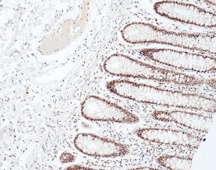 Quartett - MLH1 - QM003 - Mus - 1ml - Konc.