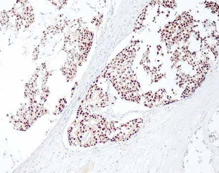 Quartett - Estrogen receptor - QR013 - Kanin - 0.5ml - Konc.