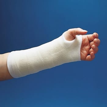 Gips Scotchcast Plus kunstgips 82004 101mm