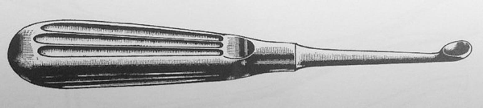 Skarp skje Volkmann fig 2