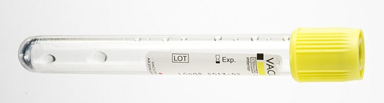Vakumrør Vacuttest ACD/A 9 ml lys gul