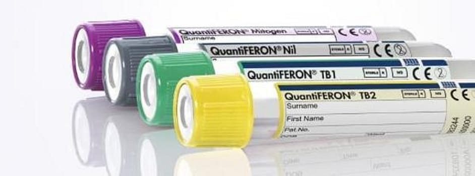 Quantiferon tb gold plus qft-plus