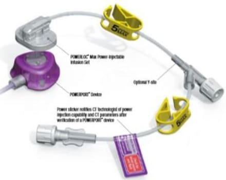 Venportsnål Powerloc Max 0,9x25mm. Steril, stickskyddad, max 5ml/sek