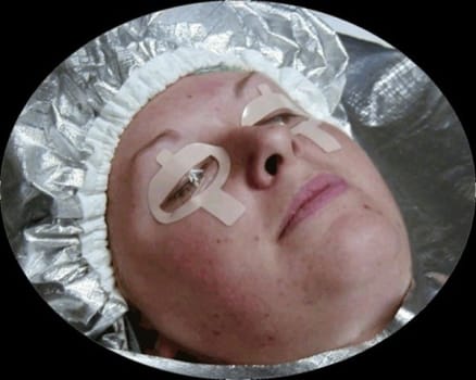 Ögonskydd Cornea Care