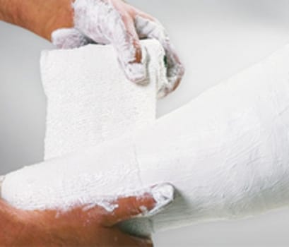 Kalkgips Cellona 6cmx2m gasväv 100% blekt bomull