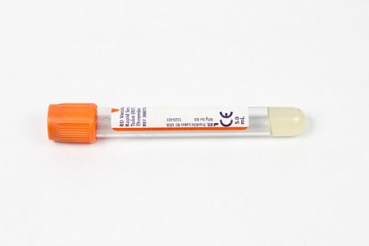 Vakuumrör vacutainer rst tromb gel 7/5ml orange papper
