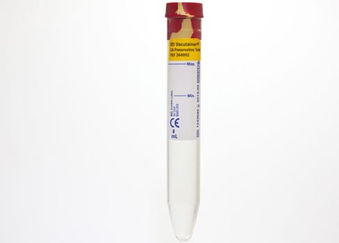 Vakuumrör vacutainer tillsats urin 10/8ml gul/röd propp papper konisk