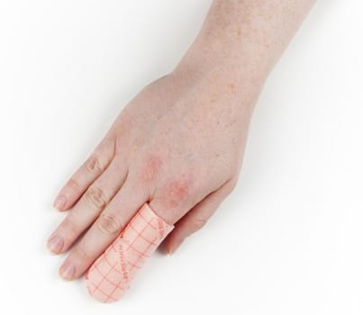 Förband Polyuretan Finger/Tå 3x8cm Small, Polymem