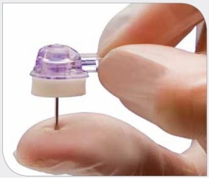 Venportsnål Gripper Micro 1,0x25mm. Steril, stickskyddad latexfri