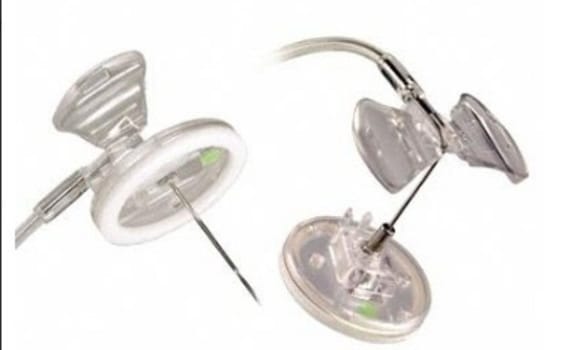 Venportsnål Surecan Safety 1,0x15mm. Steril, PVC-fri stickskyddad
