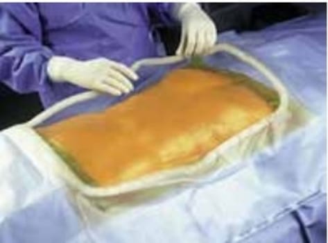 Incisionsduk Ioban2 33x43cm steril transparent