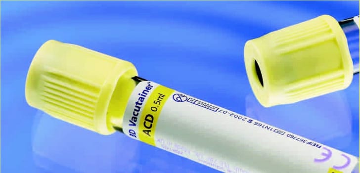 Vakuumrör vacutainer acd a blodbank 10/8,5ml gul glas papper