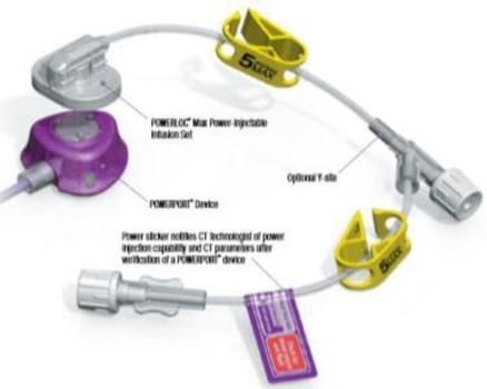 Venportsnål Powerloc Max 1,0x19mm. Steril, stickskyddad, max 5ml/sek