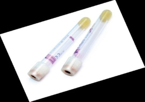 Vakuumrör vacutainer k2-edta 5ml 13x100 ppt rör