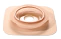 Natura Stomahesive, Moldable basisplade, 33-45mm, løftbar flange, 70 mm ring