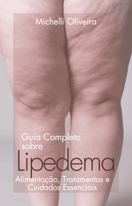 Guia Completo Sobre Lipedema - Alimentação, Tratamentos e Cuidados Essenciais — imagem 2