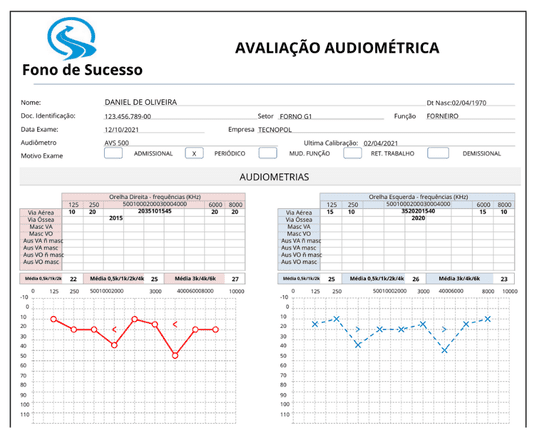 Modelo de Audiometria Ocupacional Digital Bônus Fono de Sucesso