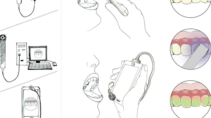 Biomarker Imaging with Mobile Phones