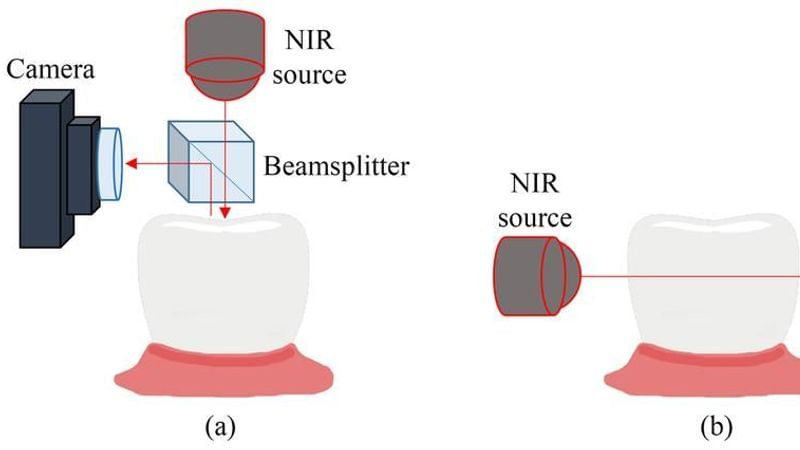 Near-Infrared-Transillumination-for-Dental-3D- Radiography-and-Cone-Beam-Computed- Tomography-Imaging