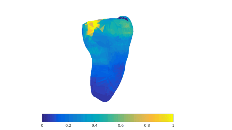 Non-Ionizing Imaging for 3D Radiography instead of Cone-Beam Computed Tomography